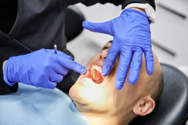 Best Dentist for Tooth Abscess  in Zephyrhills West, FL