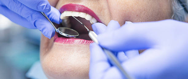 Best Chipped Tooth Repair Near Me  in Zephyrhills West, FL